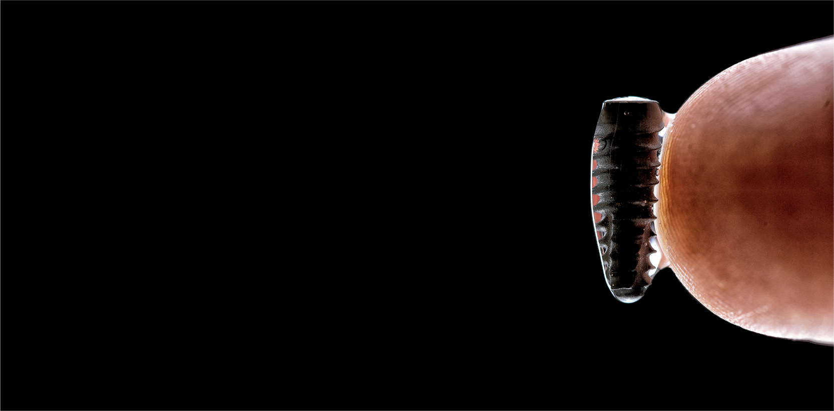 Implantes dentales