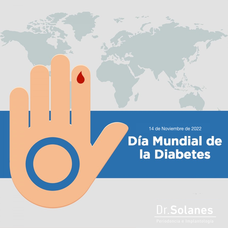 14 De Noviembre, día mundial de la diabetes.  ¿ Cuál es su relación con la enfermedad periodontal ?