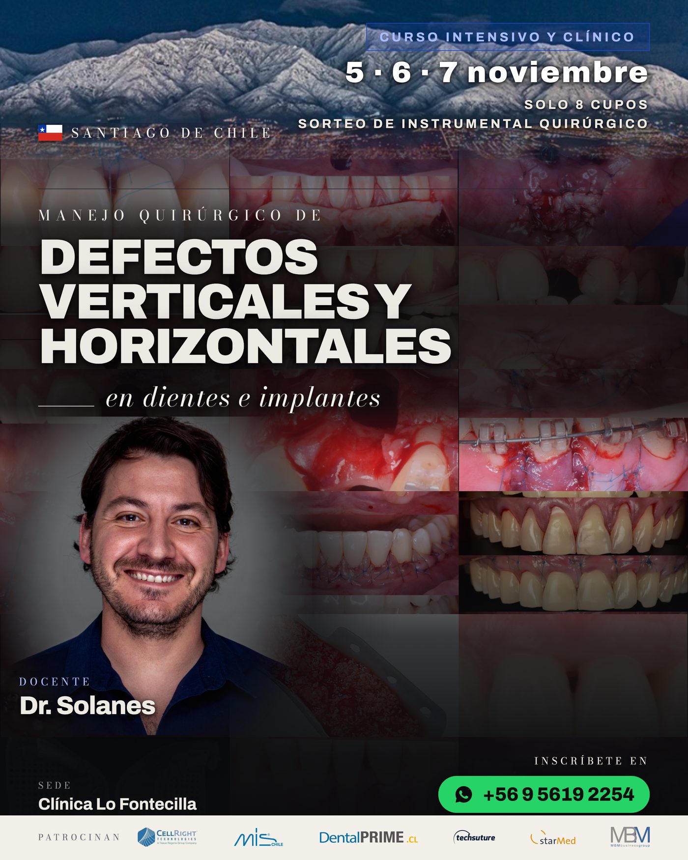 Afiche curso Manejo Quirúrgico de Defectos Verticales y Horizontales, 5-6-7 noviembre, Clínica Lo Fontecilla